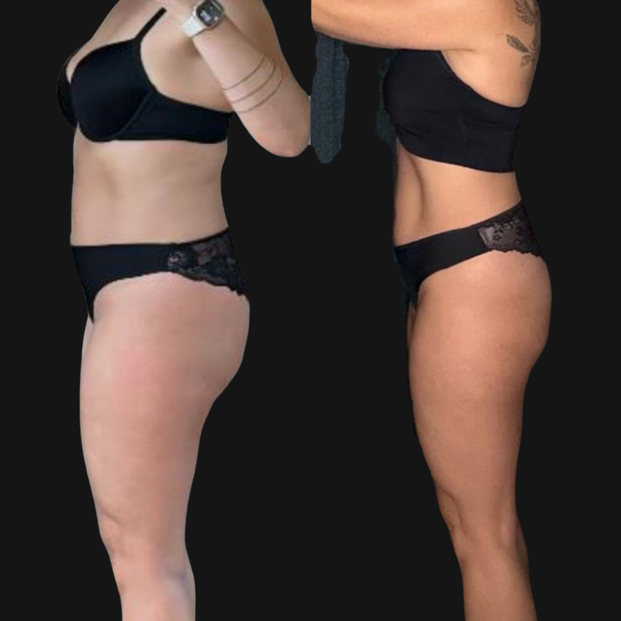 Natasha transformation