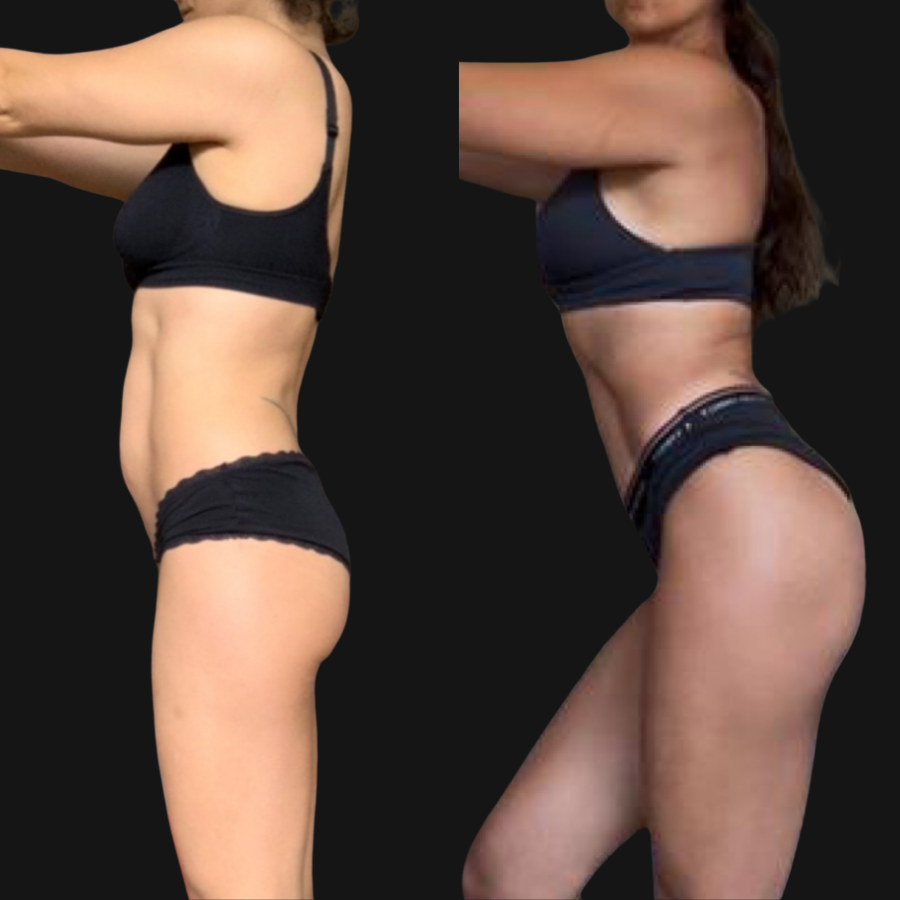 Julia transformation