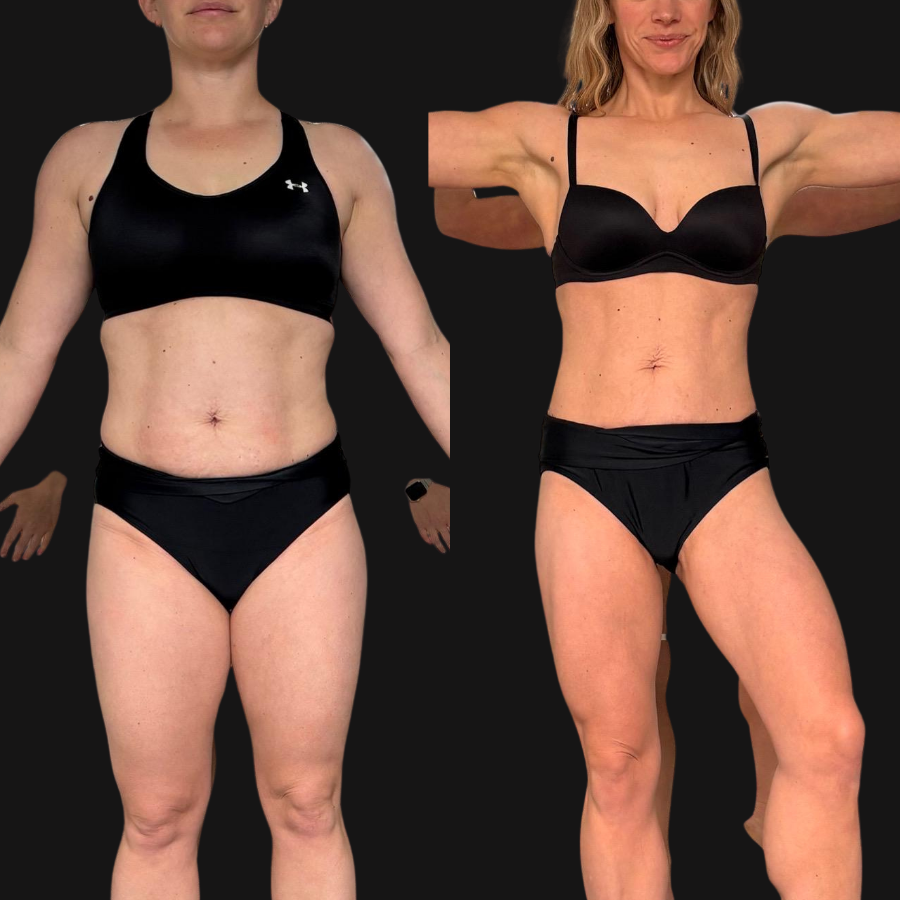 Erica transformation