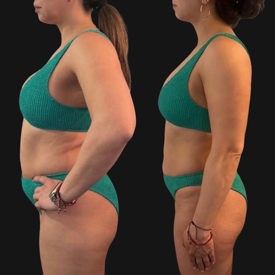 ROCIO transformation