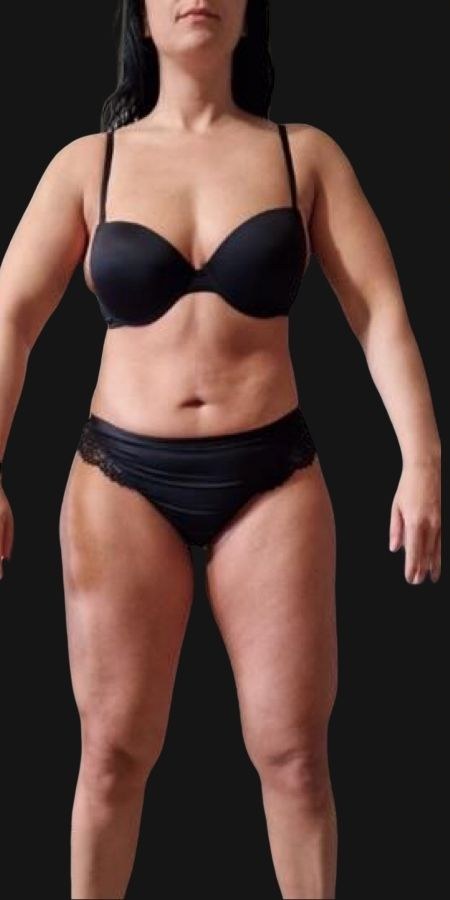 Patricia Before